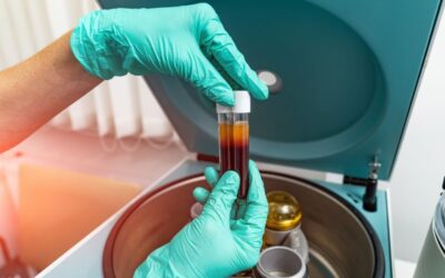 Αυτόλογο Biofiller