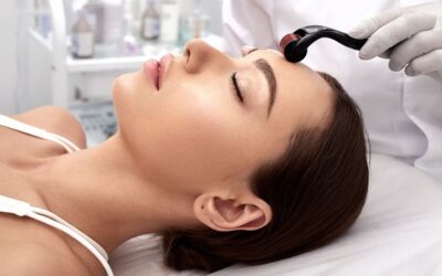 Microneedling
