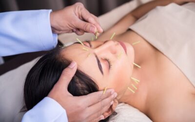 Αισθητικός Βελονισμός