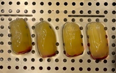 Μεμβράνες PRF