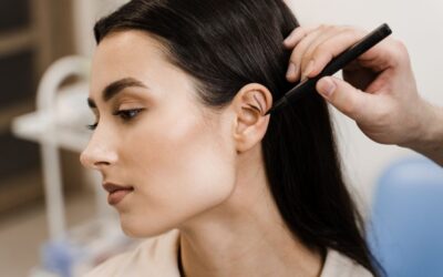 Ωτοπλαστική