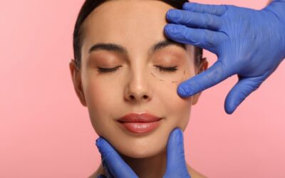 Βλεφαροπλαστική