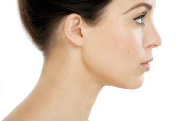 Ρινοπλαστική