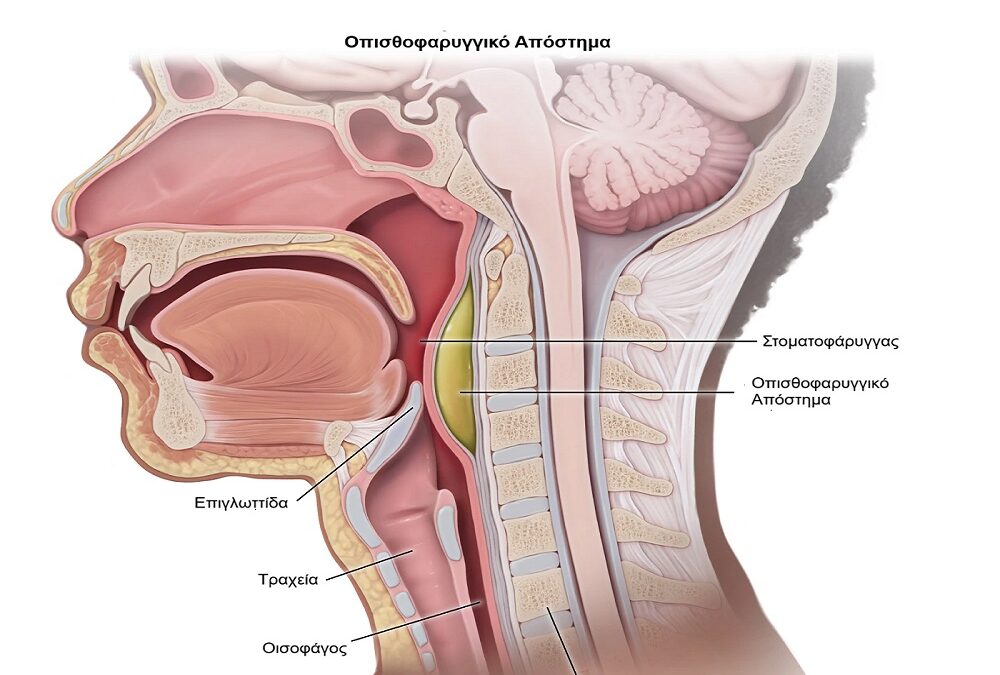 Τραχηλοπροσωπικές Λοιμώξεις