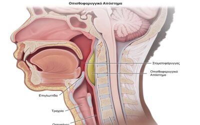 Τραχηλοπροσωπικές Λοιμώξεις